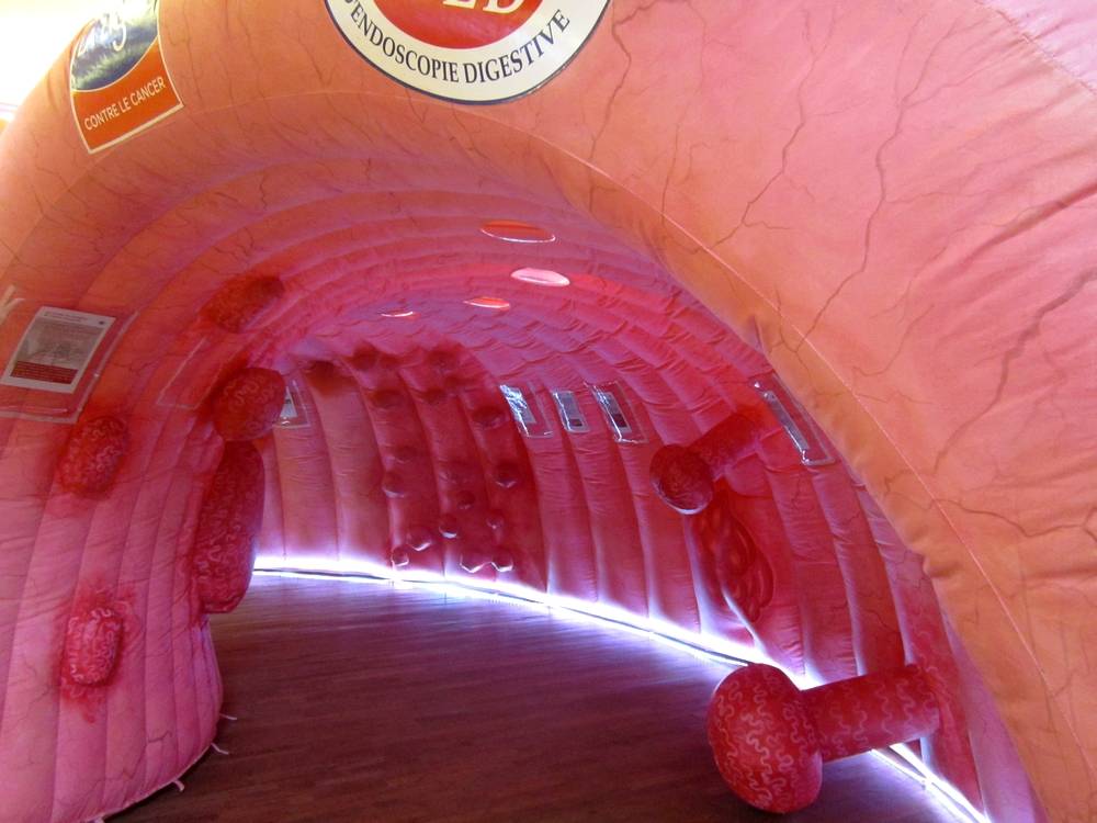 colon géant